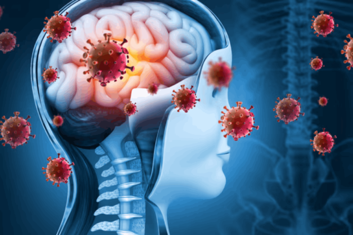 Meningitis Gagana