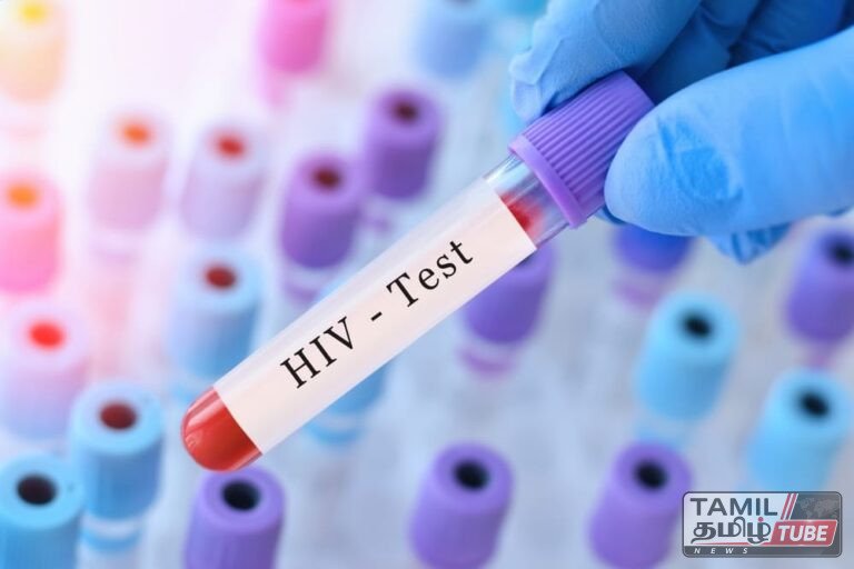 நாட்டில் HIV தொற்றாளர்களின் எண்ணிக்கை அதிகரிப்பு